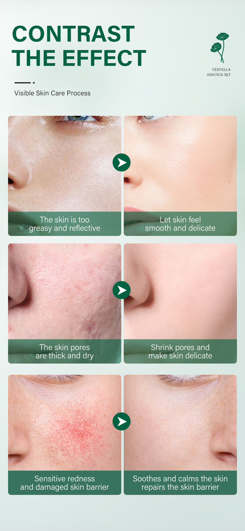 Botanical Radiance Centella Skincare Ensemble